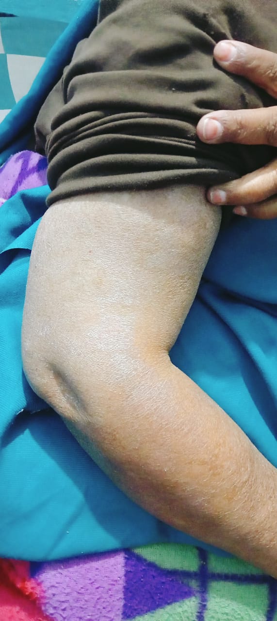 After Skin Problem